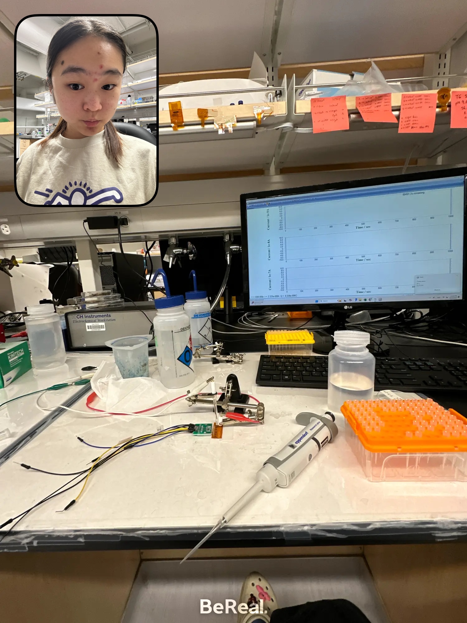 Kidney Disease Biosensor